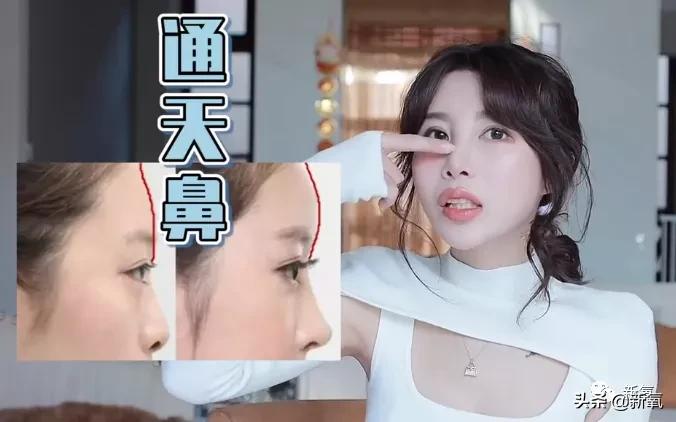 网红整鼻子整出坑,千万网红被坑