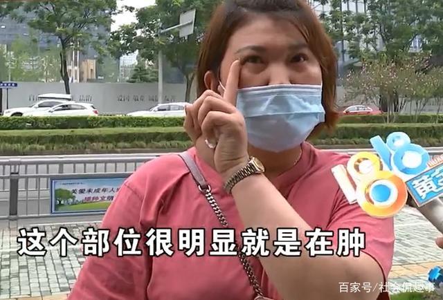 整容鼻子眼睛肿了怎么办,整容眼睛肿