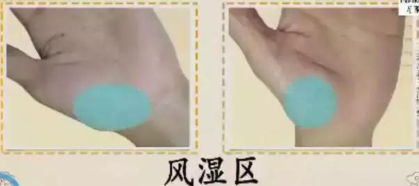 10种常见病对照表,100种常见病诊断