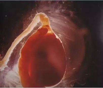 每一个都那么拼命前进，我们还好意思去选择性别吗？