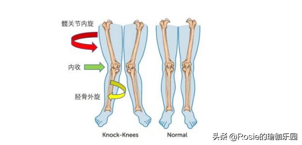 腰细臀大腿粗怎么瘦,腰细腿粗怎么瘦最快