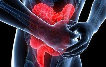 手术后肠子粘连是因为不运动嘛,肠粘连手术后肚子老是阵阵疼