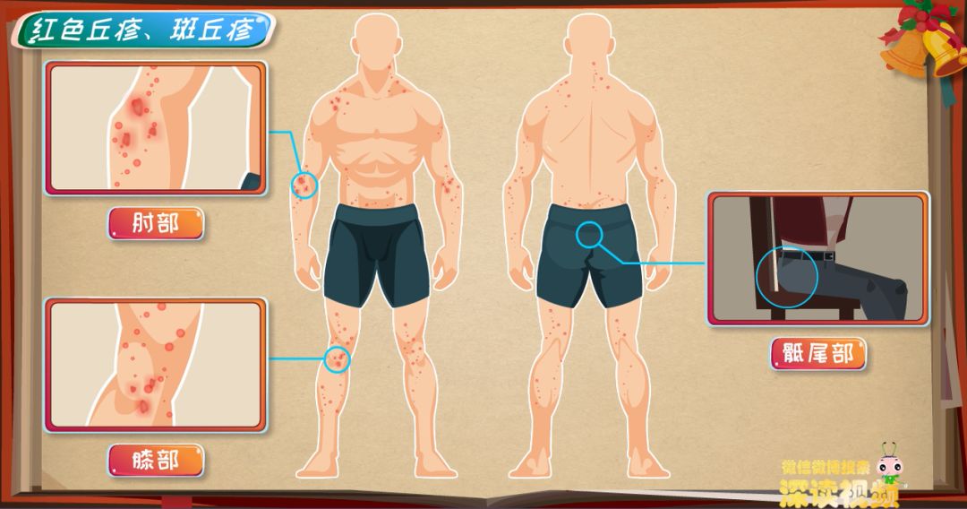 皮肤小红斑,皮肤小红点问题大全解答