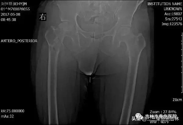 从医30余年，他治疗数以万计骨伤骨病患者