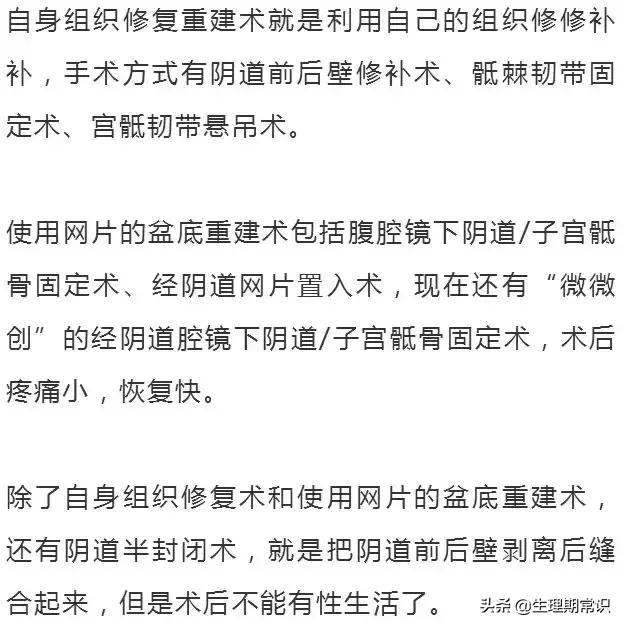 阴道里脱出块“肉”!