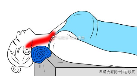 颈部僵硬康复训练方法,如何缓解肩颈肌肉僵硬