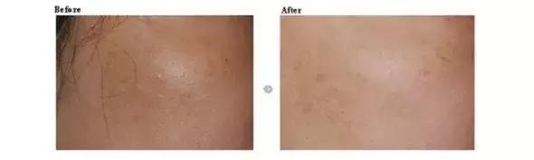 日系面膜推荐,适合干皮的日系面膜