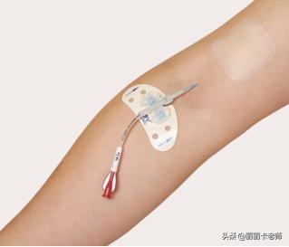 picc置管后管子往里进了怎么办,picc置管维护必须每周做一次吗