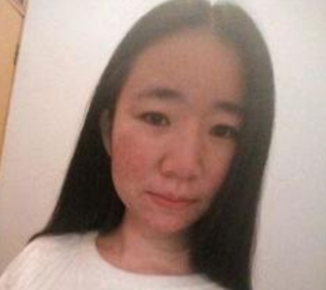 男生会喜欢脸上有痘的吗,男生会喜欢脸上有斑的女生吗