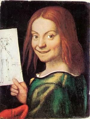 静进阿斯伯格综合征,天使综合征和孤独症的区别