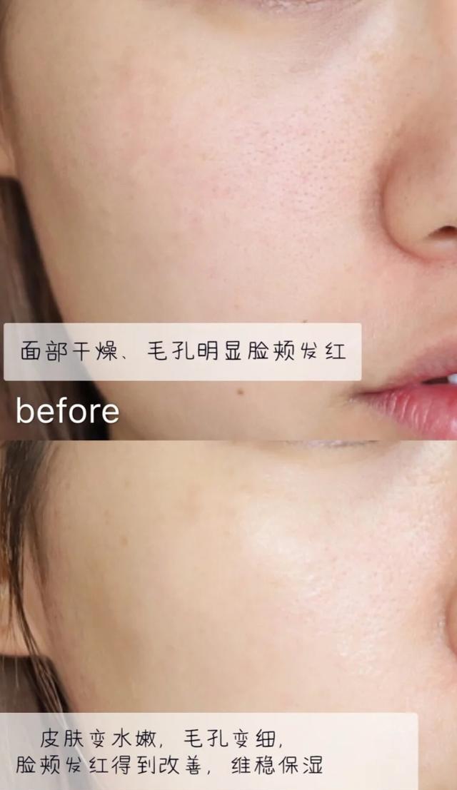 补水紧致皮肤淡化细纹面膜,保湿补水淡化细纹面膜