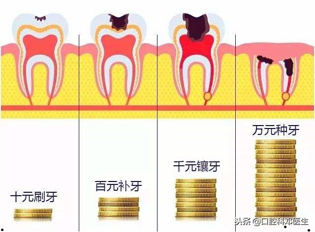如何看牙省钱牙医教你3个小方法,一个牙医的良心忠告看牙注意事项