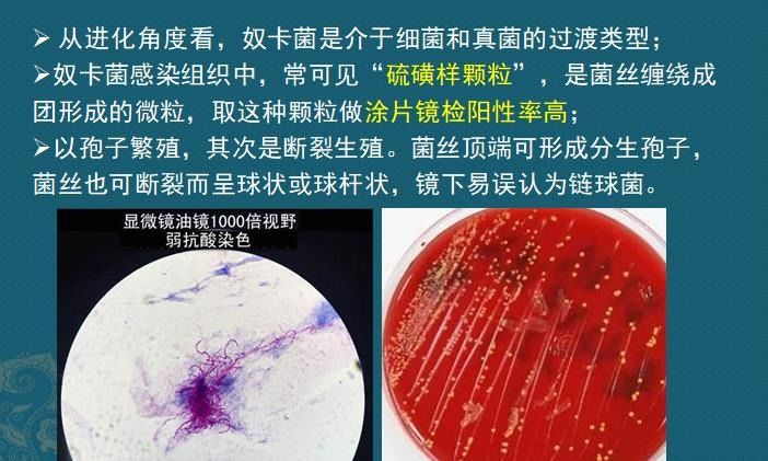 这个细菌提醒你，别买病死的鱼，它是个吃草的细菌，后来学会吃鱼