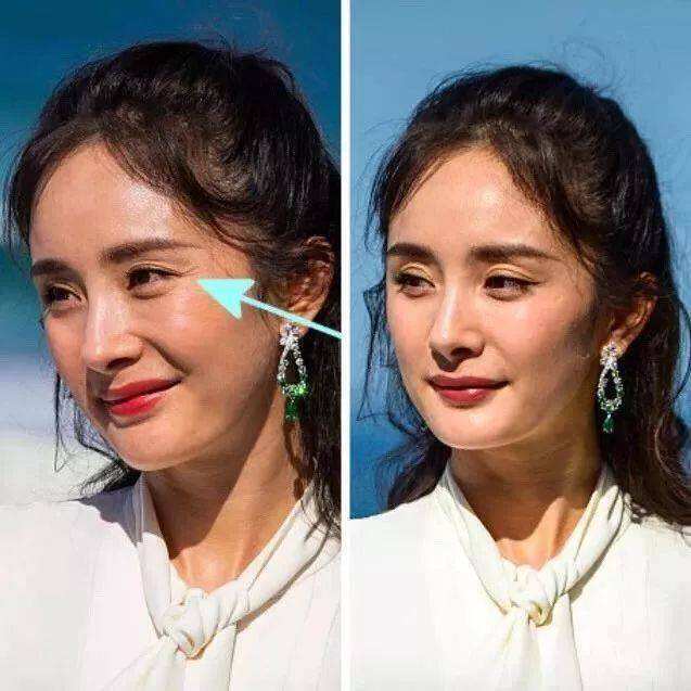 面部手法按摩去表情纹全过程,祛除表情纹的按摩手法视频