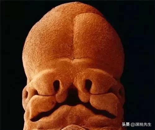 将光导管与内窥镜相机连接，向全世界展示了人类生命诞生的奥妙