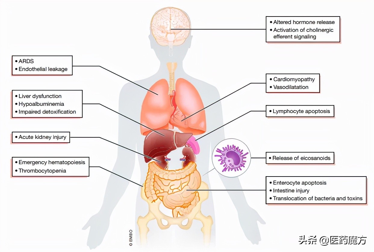 脓毒症诊断标准国际共识,脓毒症治疗的研究进展