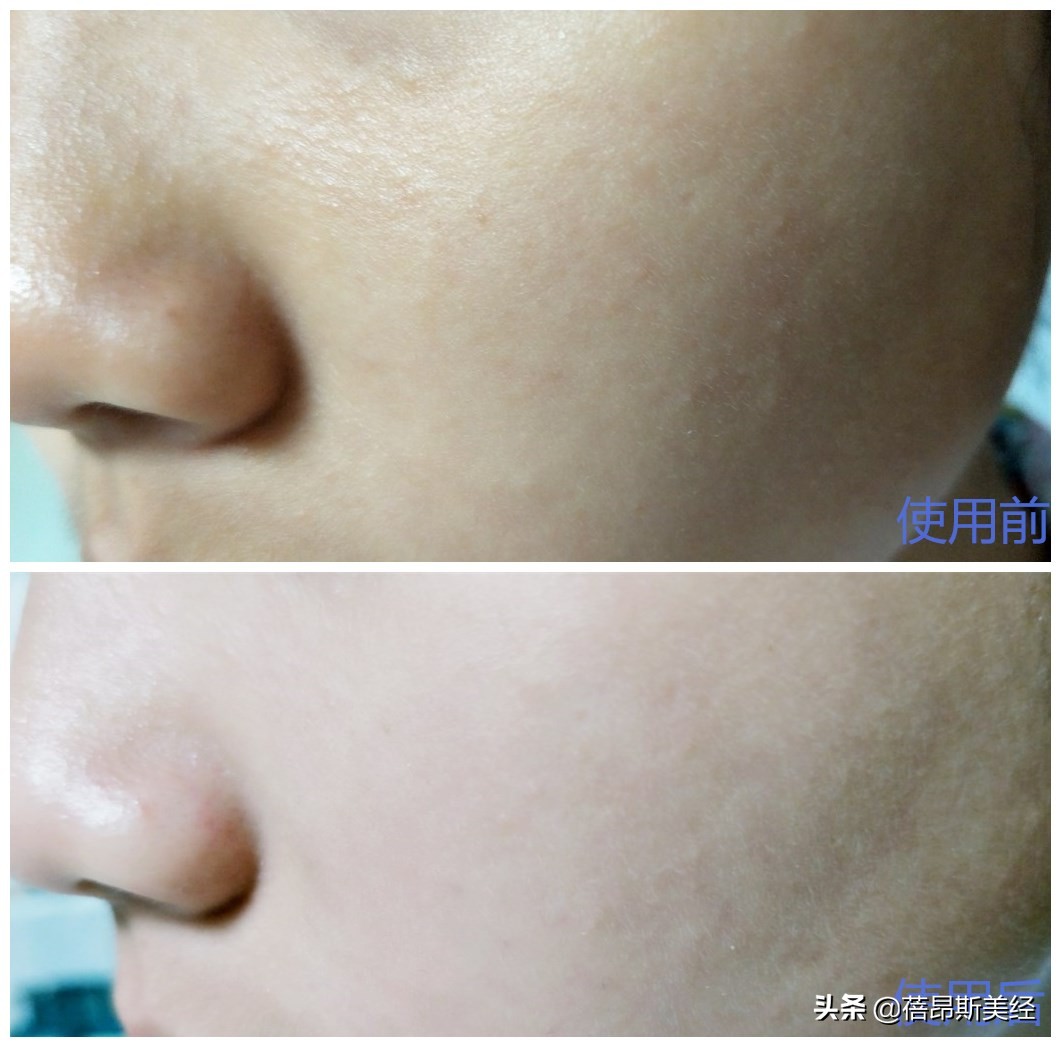 娜丽丝去角质水,娜丽丝角质调理水油皮