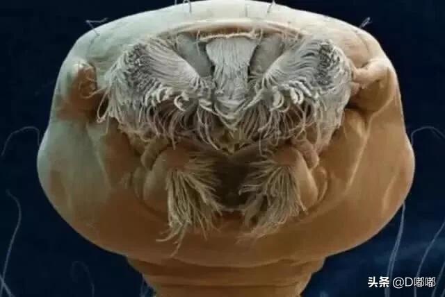 显微镜40倍分辨寄生虫,所有寄生虫在显微镜下看的样子