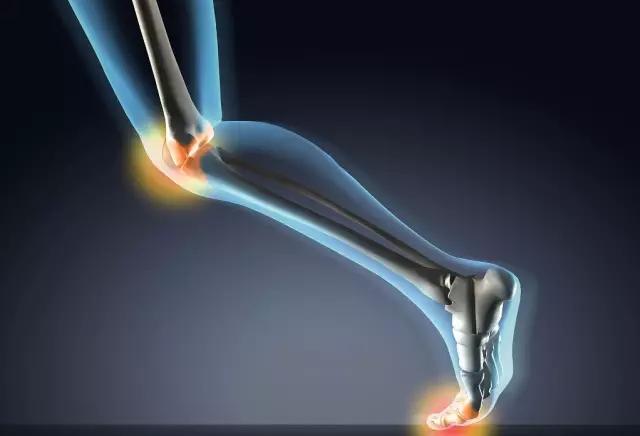 骨科专家提醒：治疗膝关节炎警惕十大误区