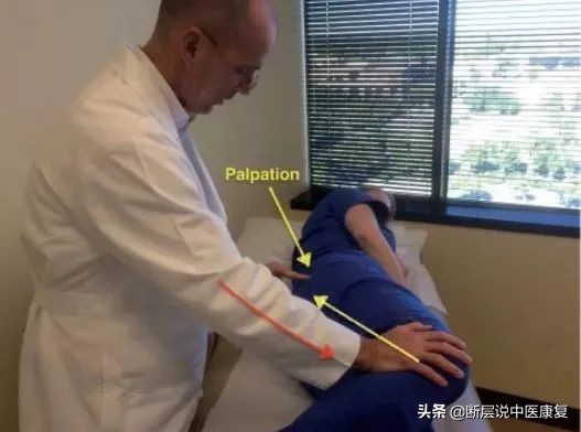 怎样才能治好梨状肌综合征,如何治疗梨状肌综合征