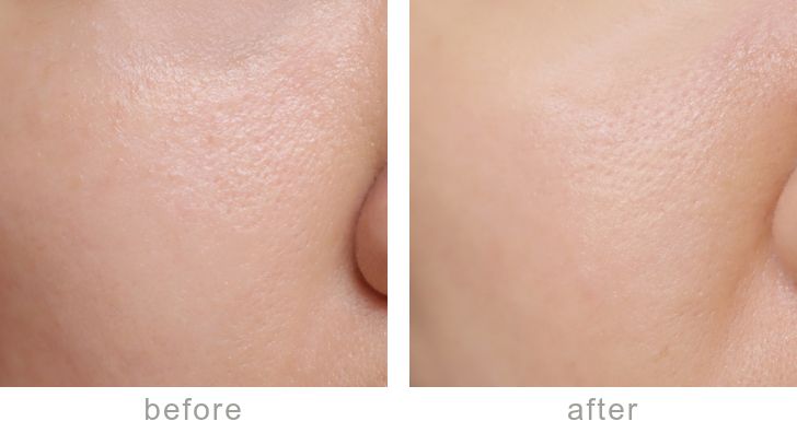 最近最火的粉底液,比较推荐的几款粉底液