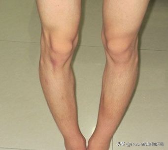 如何知道是真翘臀还是假翘臀,真翘臀和假翘臀是怎么判断的