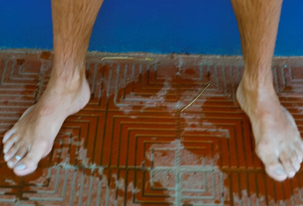 脱发与打鼾有关系吗,打呼噜和脱发的关系