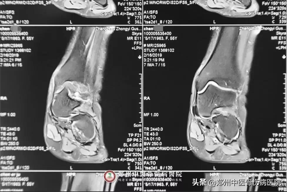 她辗转多家医院治疗未见好转,终在这里成功解除病痛!