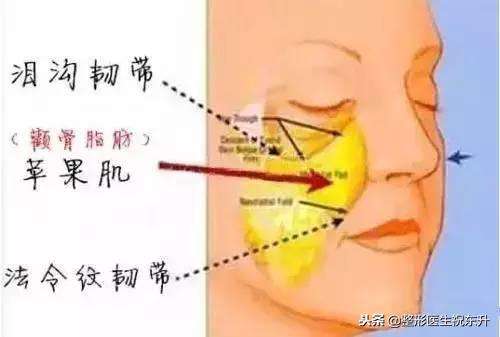 法令纹显老10岁三种方法帮助改善,脸上有法令纹最好解决的办法
