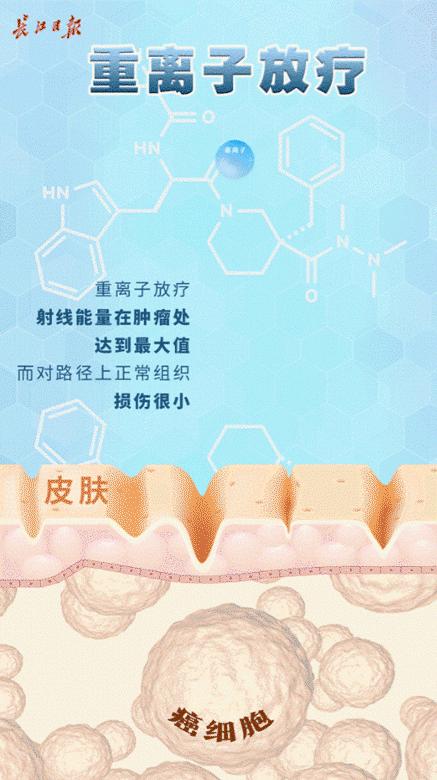 重离子中心武汉市,武汉重离子治愈癌症