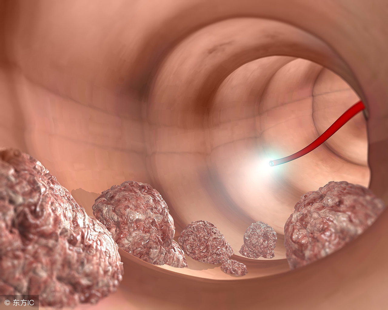 肿瘤内科主任年终个人总结,肿瘤诊治高峰论坛