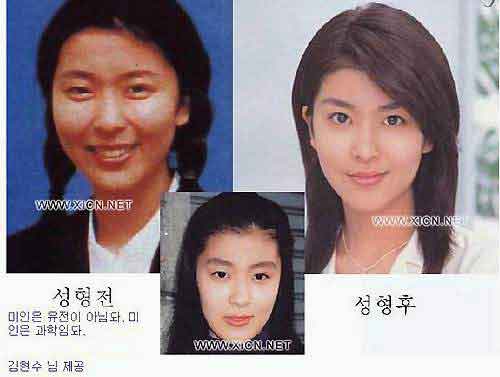 日本整容惊人案例,日本整容是不是最先进