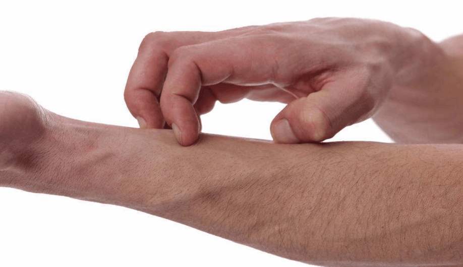 起痘痘的地方反复长痘是什么原因,经常长痘痘是什么原因怎么解决