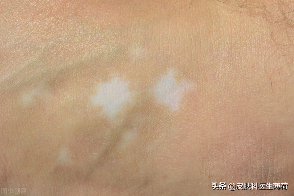 医生美白护肤小妙招,医生皮肤暗沉发黄如何提亮肤色