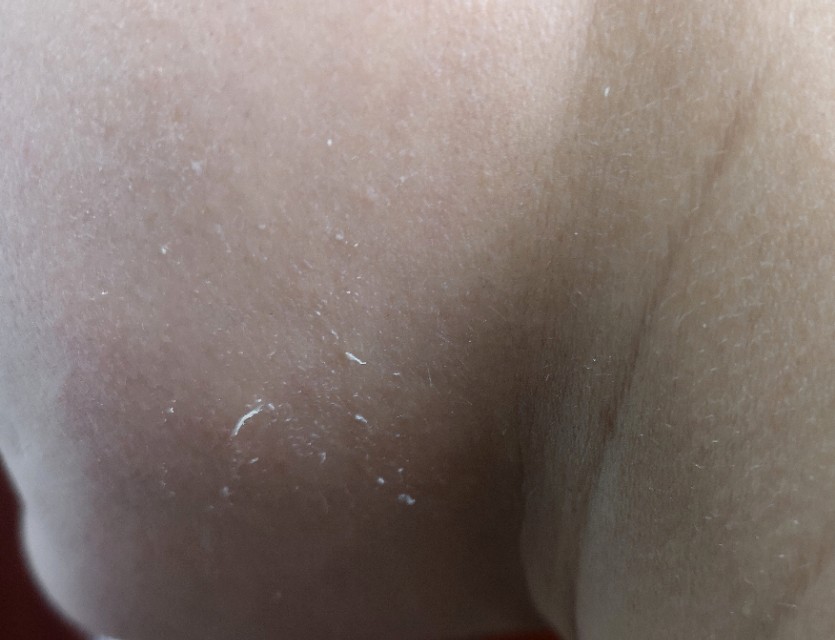 搓泥的真的是污垢吗,搓泥现象是护肤品的问题吗