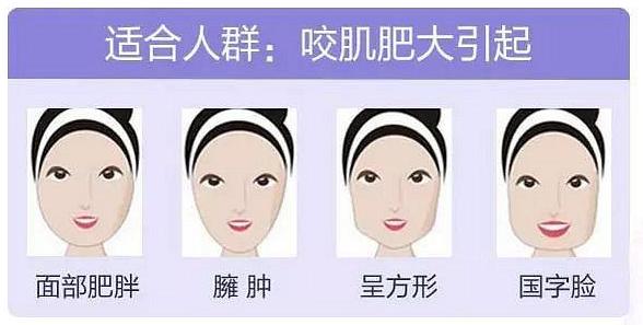 瘦脸针拯救脸部不适告别大饼脸,打完瘦脸针感觉脸部僵硬