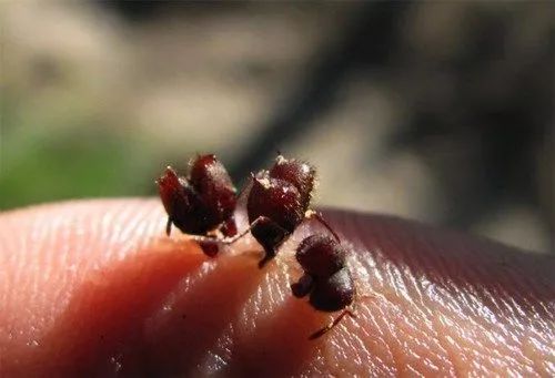 蚂蚁和羊肠是怎么把你和你“缝”在一起的?