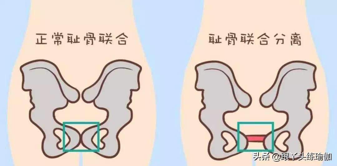 松弛素的影响,松弛素对女性塑形的好处