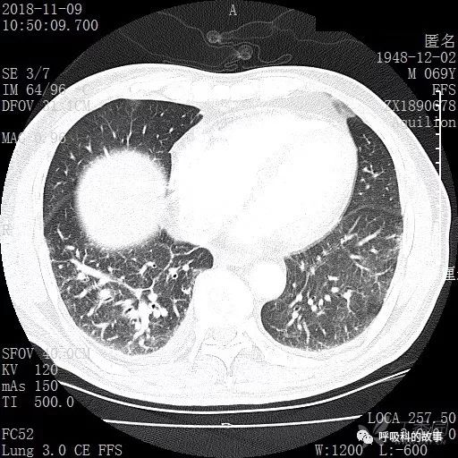怎么应用统计学做调查,统计学方法可以解决的主要问题