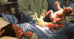 宝妈月子腰疼是什么原因,产后腰痛怎么在月子里调养好