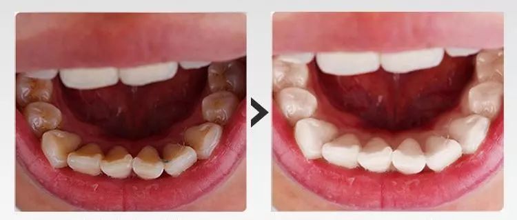 限时疯抢全国包邮,限时抢购全部68折优惠