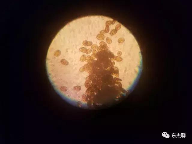 海缸的丝藻是褐色的,海缸控磷