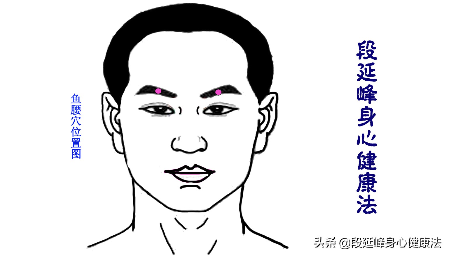 严重黑眼圈可以逆转吗,延峰治疗黑眼圈