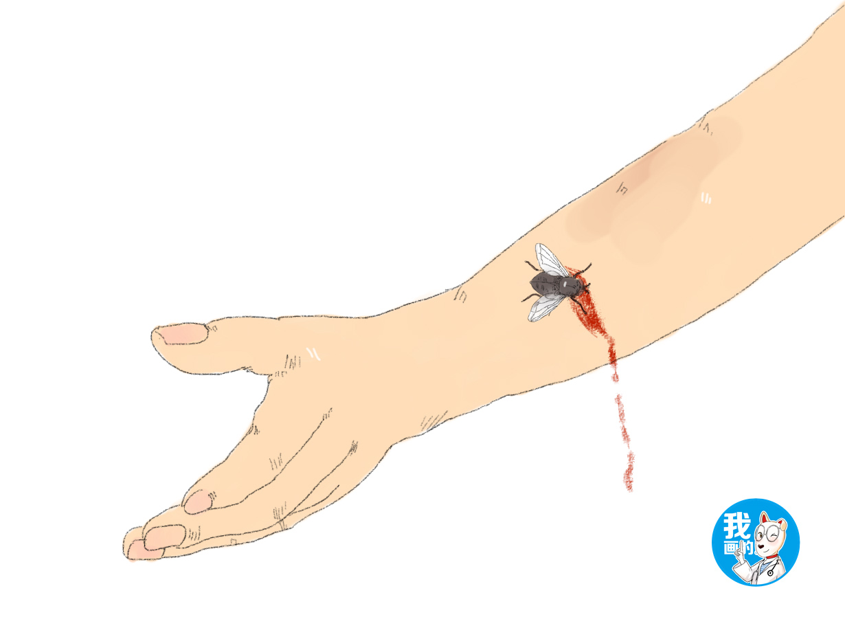 苍蝇一碰就跟针扎一样疼,男子手臂爬进去一只虫子