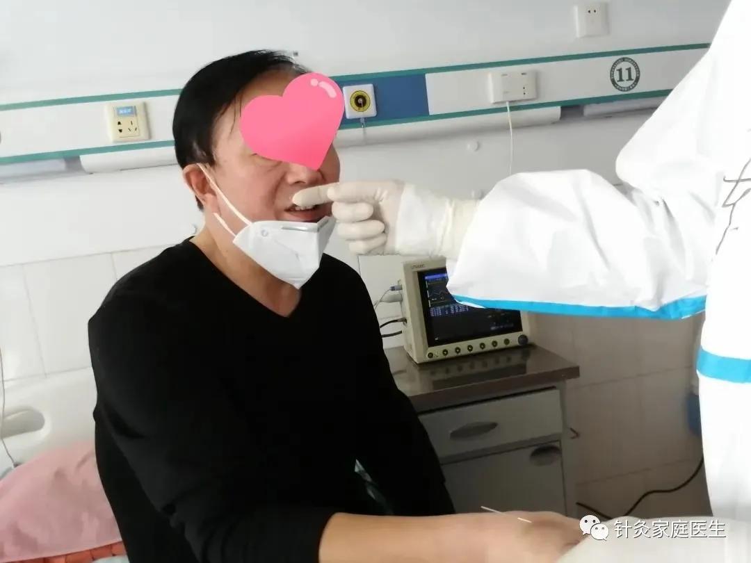 针灸对新冠的效果,针灸治疗新冠肺炎咳嗽痰多