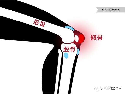 大重量深蹲对男性的好处,深蹲属于无氧训练还是有氧训练