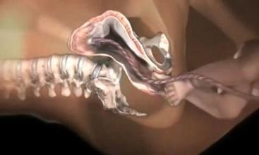 产道那么小怎么顺产,产道那么小胎儿怎么出来的