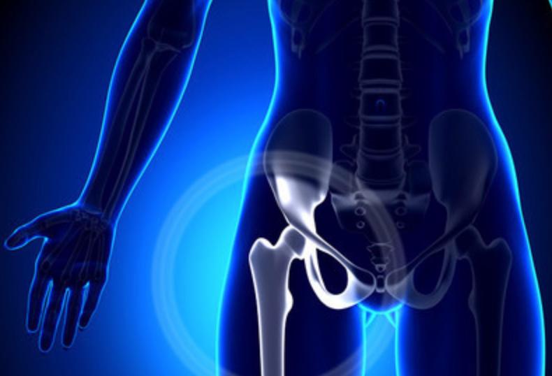 髋臼发育不良截骨的原理,髋臼截骨后会有长短腿吗