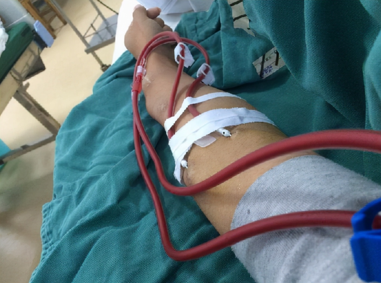 a型b型o型ab型哪种血型比较稀少,血型a型b型ab型o型哪种最健康