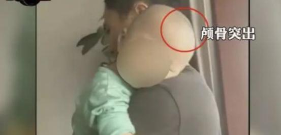 湖南郴州大头娃娃奶粉持续发酵,郴州大头娃娃奶粉事件